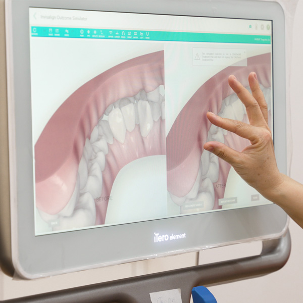 nieng-rang-hai-phong-o-dau-tot-top-dia-chi-uy-tin-bang-gia