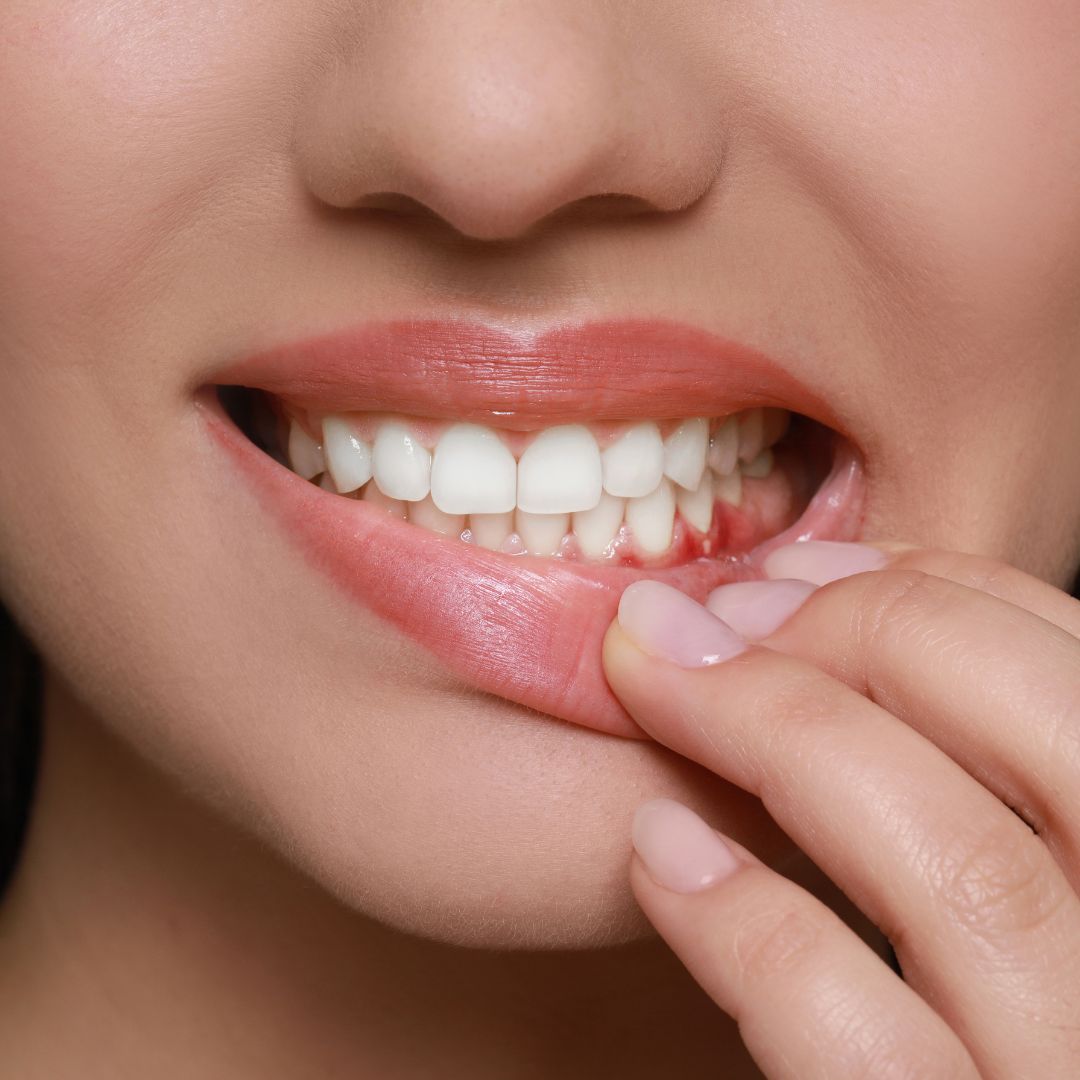 Tại sao không nên làm răng sứ giá rẻ?