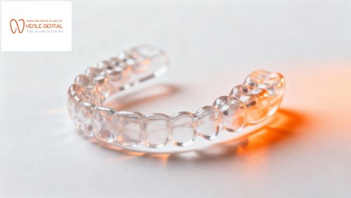 Niềng răng mắc cài sứ trong suốt – Giải pháp tối ưu