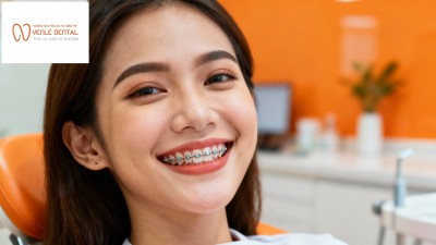 Dịch vụ niềng răng chất lượng cao tại Hải Phòng