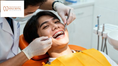 Niềng răng không mắc cài – Công nghệ tiên tiến tại Hải Phòng
