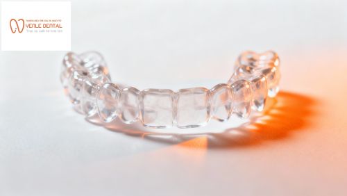 Niềng răng trong suốt cao cấp – Công nghệ tiên tiến