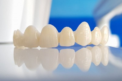 So sánh răng sứ Zirconia, Cercon, Lava, HT Smile: