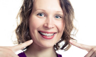 NGƯỜI LỚN TUỔI CÓ NIỀNG RĂNG ĐƯỢC KHÔNG?