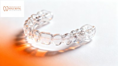 Niềng răng mắc cài trong suốt Sapphire – Tinh tế và bền đẹp