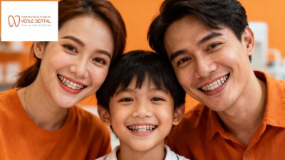 Niềng răng mắc cài kim loại kết hợp dây cung thẩm mỹ