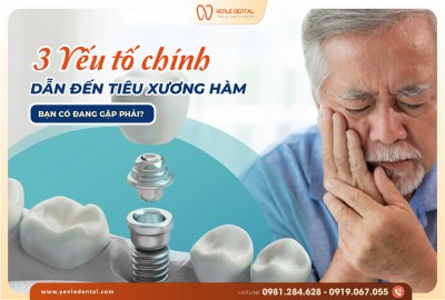 3 YẾU TỐ CHÍNH DẪN ĐẾN TIÊU XƯƠNG HÀM – BẠN CÓ ĐANG GẶP PHẢI?