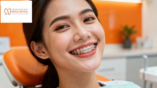 Hình ảnh trước và sau niềng răng tại Hải Phòng