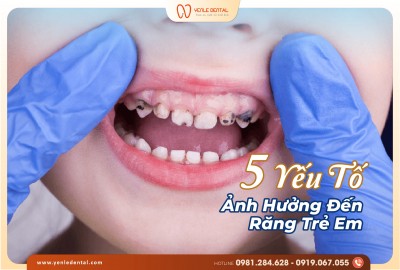 5 Yếu Tố Ảnh Hưởng Đến Sức Khỏe Răng Trẻ Em – Cha Mẹ Cần Lưu Ý