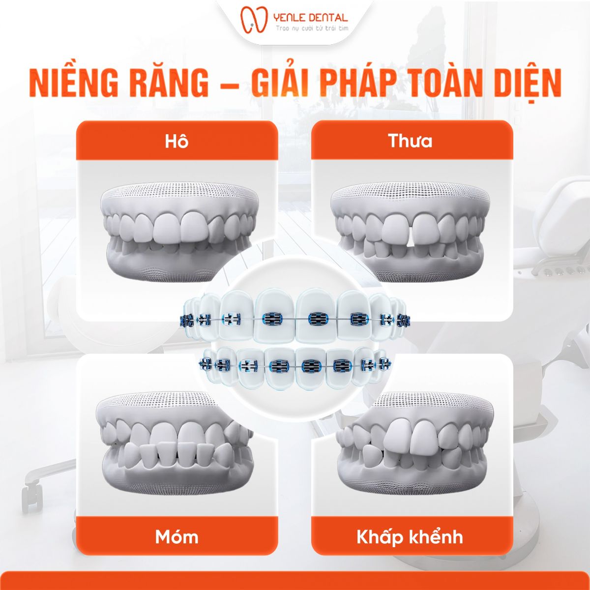 Niềng răng uy tín Hải Phòng - Yenle Dental