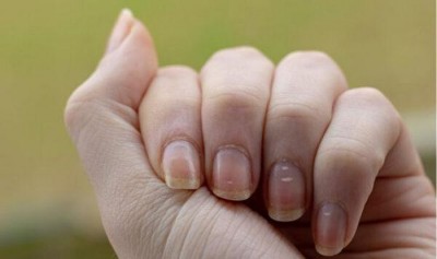 1 phút dự đoán sức khỏe thông qua dấu hiệu trên ngón tay!