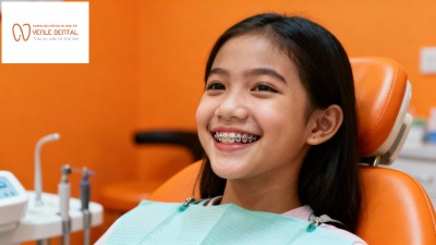 Niềng răng mắc cài truyền thống – Phương pháp phổ biến