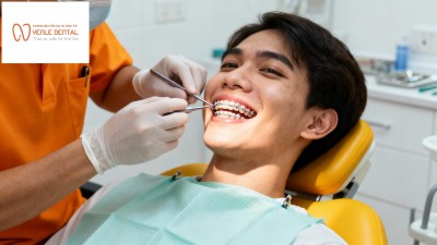 Niềng răng Hải Phòng – Địa chỉ bác sĩ giàu kinh nghiệm