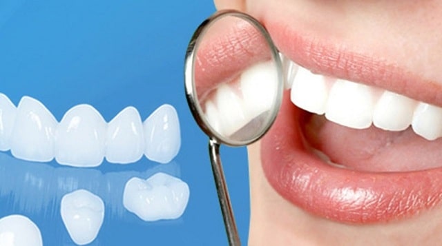 Có khá nhiều rủi ro có thể xuất hiện sau khi làm răng sứ