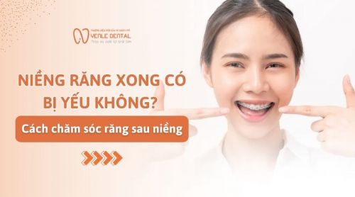 Niềng răng xong có bị yếu không? Cách chăm sóc răng sau niềng