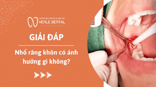 Giải đáp: Nhổ răng khôn có ảnh hưởng gì không?
