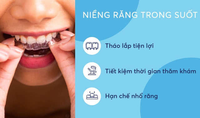 Niềng răng không mắc cài phải nhổ răng nhưng sẽ hạn chế hơn các phương pháp truyền thống