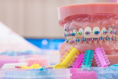 Niềng Răng Có Ảnh Hưởng Đến Thần Kinh Không?