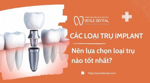 So sánh các loại trụ Implant tốt nhất hiện nay. Nên chọn loại trụ nào?