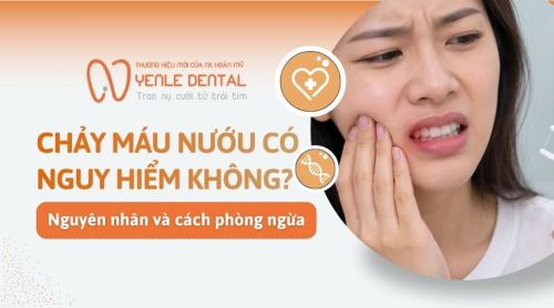 Chảy máu nướu răng có nguy hiểm không? Nguyên nhân và cách phòng ngừa
