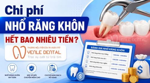 Chi phí nhổ răng khôn hết bao nhiêu tiền? Bảng giá chi tiết 2026