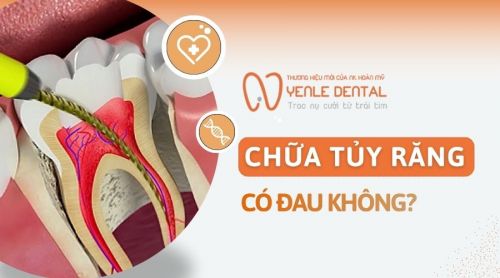 Chữa tủy răng có đau không? Khi nào cần điều trị tủy?