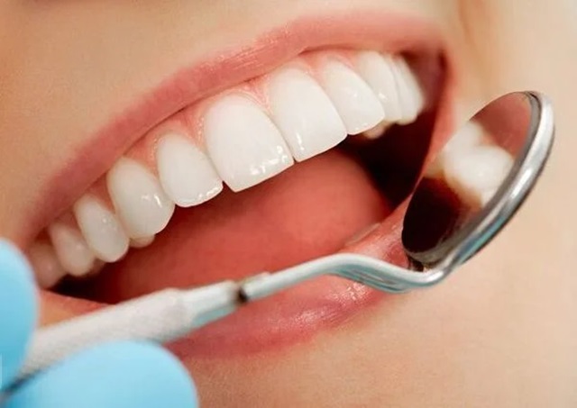 Chuẩn bị răng trước khi bọc sứ