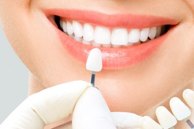 Giải đáp thắc mắc có nên bọc răng sứ zirconia hay không?