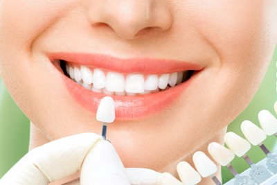 Có nên lựa chọn răng sứ cercon để bọc sứ hay không?