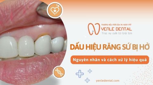 Dấu hiệu răng sứ bị hở và cách xử lý hiệu quả