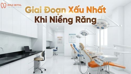 Giai Đoạn Xấu Nhất Khi Niềng Răng Phải Làm Sao?