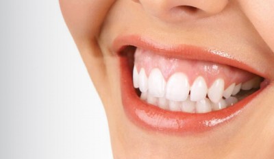 CƯỜI HỞ LỢI – ĐỪNG LO! ĐÃ CÓ NHIỀU GIẢI PHÁP HIỆU QUẢ & AN TOÀN