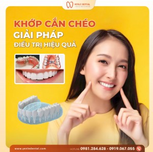 KHỚP CẮN CHÉO: TRIỆU CHỨNG & GIẢI PHÁP ĐIỀU TRỊ HIỆU QUẢ