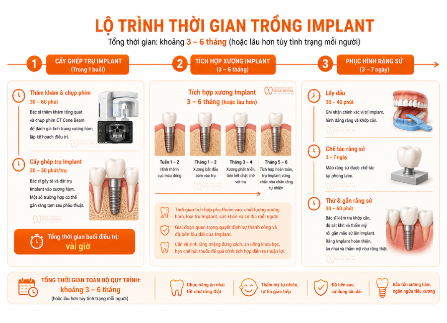 lộ trình trồng răng Implant