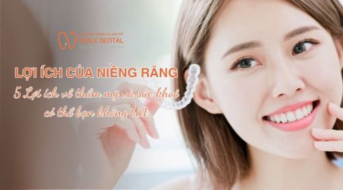 Những Lợi Ích Của Niềng Răng Với Thẩm Mỹ Và Sức Khỏe Bạn Nên Biết