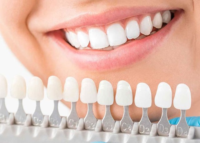 Màu sắc tự nhiên giống răng thật