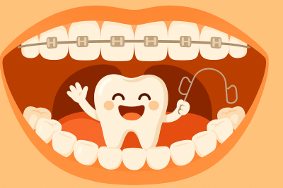 Niềng răng tại quận Lê Chân – Hải Phòng