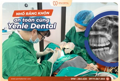 Ca nhổ răng phức tạp – Sự an toàn và chuyên môn cao tại Nha khoa Yenle Dental