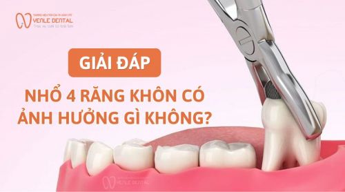 Bác sĩ giải đáp: Nhổ 4 răng khôn có ảnh hưởng gì không? 