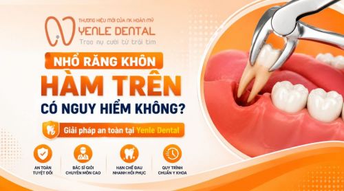 Nhổ răng khôn hàm trên có nguy hiểm không? Giải pháp an toàn tại Yenle Dental