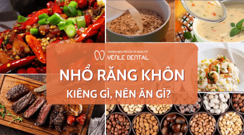 Nhổ răng khôn kiêng gì, nên ăn gì? Những lưu ý quan trọng sau khi nhổ răng