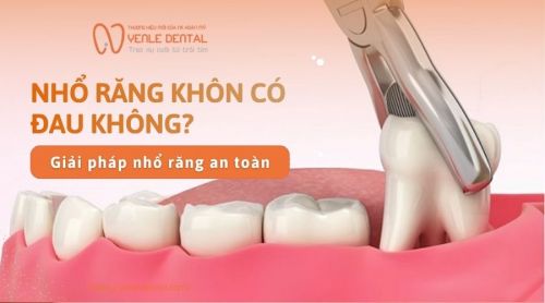 Nhổ răng khôn có đau không? Giải pháp nhổ răng an toàn