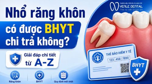 Nhổ răng khôn có được BHYT chi trả không? Giải đáp chi tiết từ A-Z