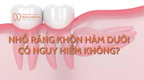 Nhổ răng khôn hàm dưới có nguy hiểm không? 7+ Biến chứng nguy hiểm cần lưu ý