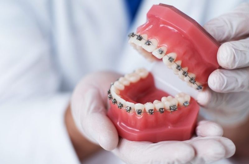 nieng-rang-cho-tre-em-co-nen-hay-khong