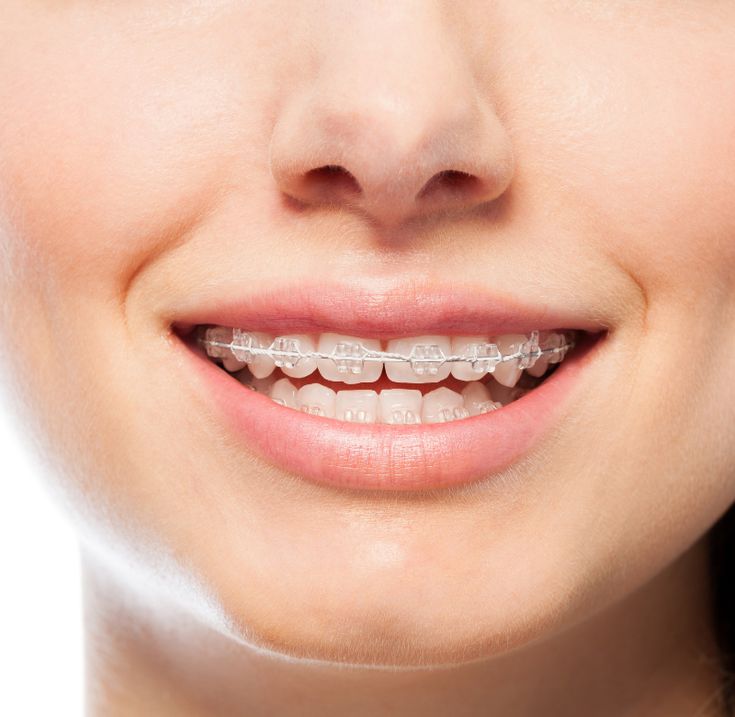 nieng-rang-thua-co-hieu-qua-khong-dia-chi-uy-tin