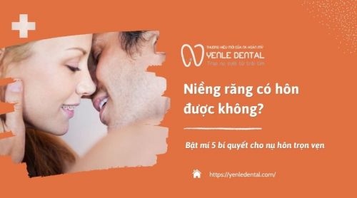 Niềng răng có hôn được không? Bật mí 5 bí quyết cho nụ hôn trọn vẹn 