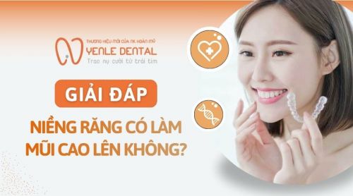 Bác sĩ giải đáp: Niềng răng có làm mũi cao lên không?