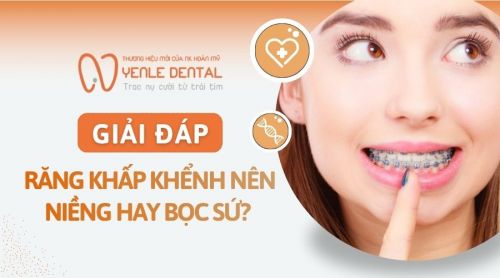 Răng khấp khểnh nên niềng hay bọc sứ? Đâu là lựa chọn tối ưu?