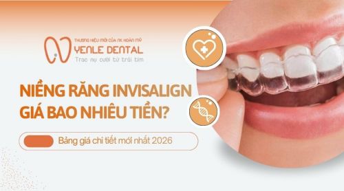 Niềng răng Invisalign giá bao nhiêu tiền? Bảng giá chi tiết mới nhất 2026